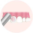 歯の表面をツルツルに仕上げ磨き